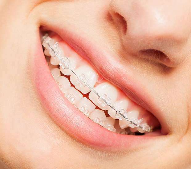 El Centro Invisible Orthodontics