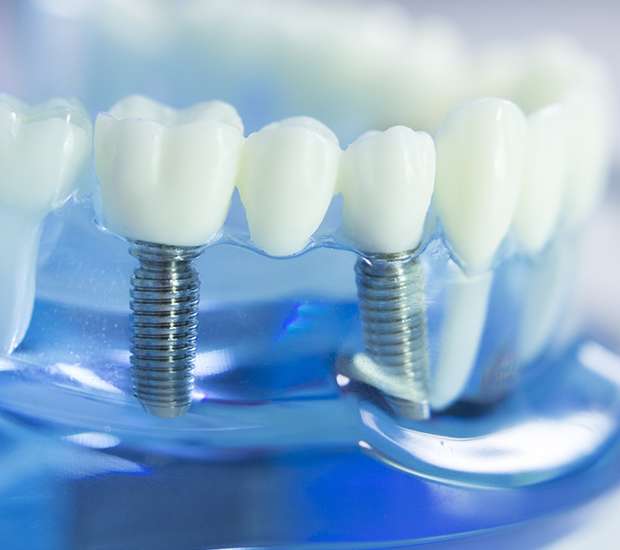 El Centro Dental Prosthetics