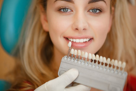 Dental Veneers