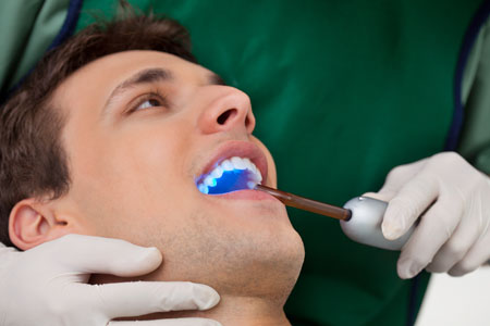 Laser Dentistry