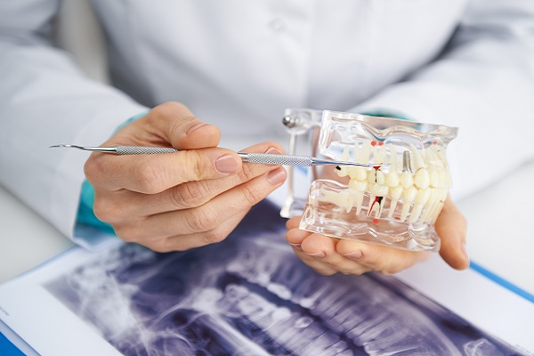 implant supported dentures El Centro, CA