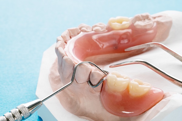 When Does A Dentist Use Partial Dentures To Replace Missing Teeth?